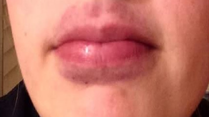 How to make the kylie jenner lip challenge go away