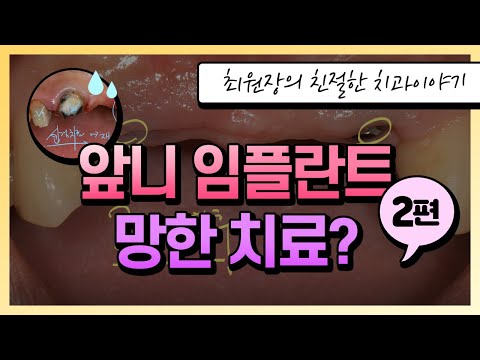 앞니 임플란트는 하면 안되는 치료인가요? 2부입니다.