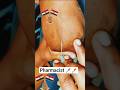 🥺🥺🤫 ||इंजेक्शन लगाने का तरीका|// pharmacist 💉💉||Dr// MBBS Dr || b.sc nursing ||💊💊💉 view 1K