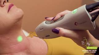 Laser treatments - Hair, Skin and Veins at BodyRx Louisville