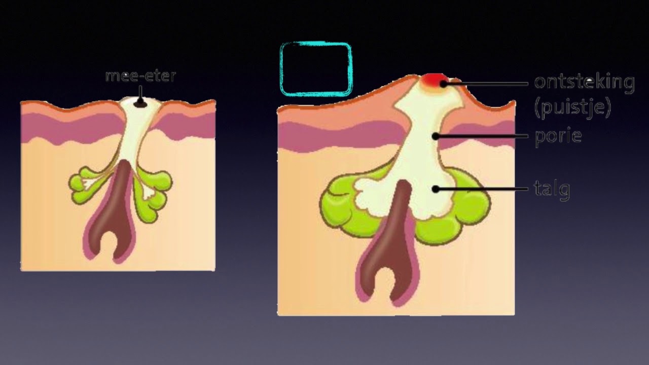 basis 5.2 biocast - YouTube
