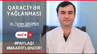 Qaraciyer Yaglanmasi - Dr Terlan Qasimov Qastroenteroloq-Endoskopist Medplus Tv
