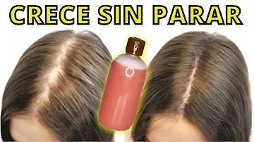 ¿Existen productos que aceleren el crecimiento del cabello?