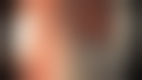 Clip closure technique of a large transverse defect