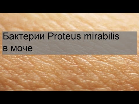 Video: Was ist proteus mirabilis?