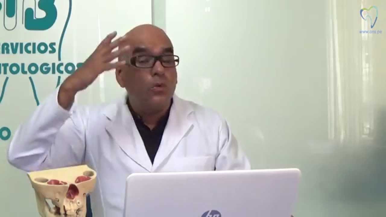 negocios desde casa Mordida cruzada esqueletal posterior Parte II: Biomecánica Ortodóntica