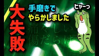 【磨きch】やってしまった大失敗・手磨きで傷だらけ