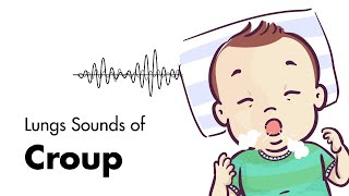 Sounds of Croup (Laryngotracheitis) - Lung Sounds - MEDZCOOL