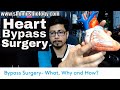 Bypass surgery Hindi (Coronary artery bypass surgery)