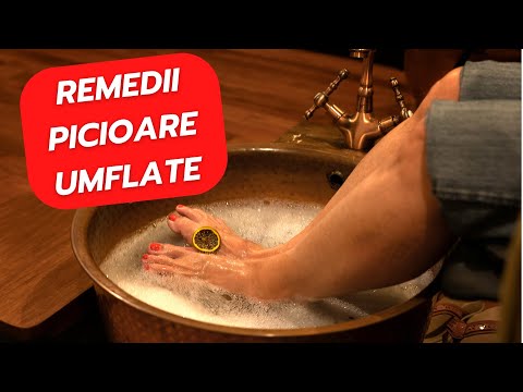 Video: Cum se reduce umflarea picioarelor (cu imagini)