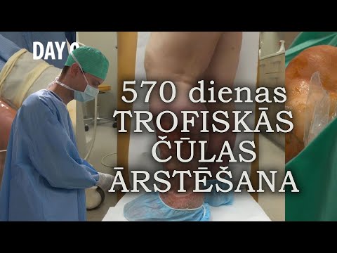 Video: Trofiskās ķēdes: piemēri un apraksts