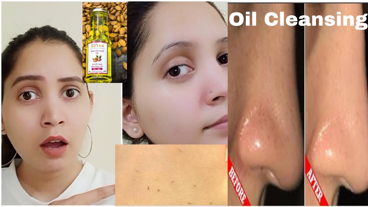 oil cleansing for whiteheads