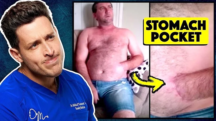 Doctor Reacts To Extreme Medical Conditions