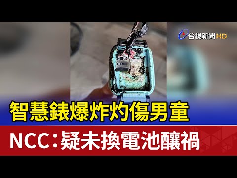 智慧錶爆炸灼傷男童 NCC：疑未換電池釀禍