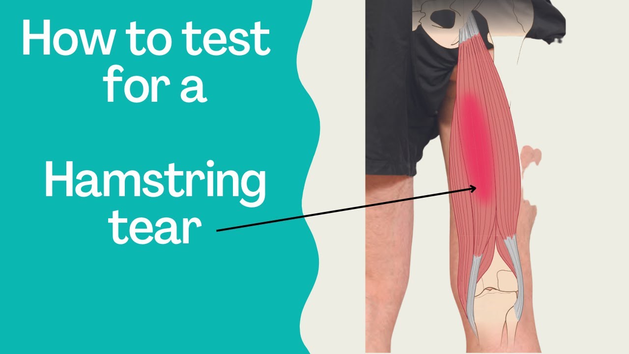 Torn Hamstrings & Glutes - This is how you test them 