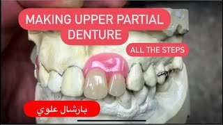 MAKING AN UPPER PARTIAL DENTURE ON METAL FRAMEWORK WITHOUT ARTICULATOR (ALL THE STEPS) IN 4K #WAXBAE
