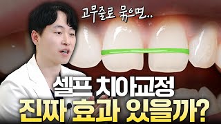 셀프 치아 교정 🦷 이 영상을 보면 절대 하고 싶은 생각 안 들 겁니다. 치아 교정은 치과에서!