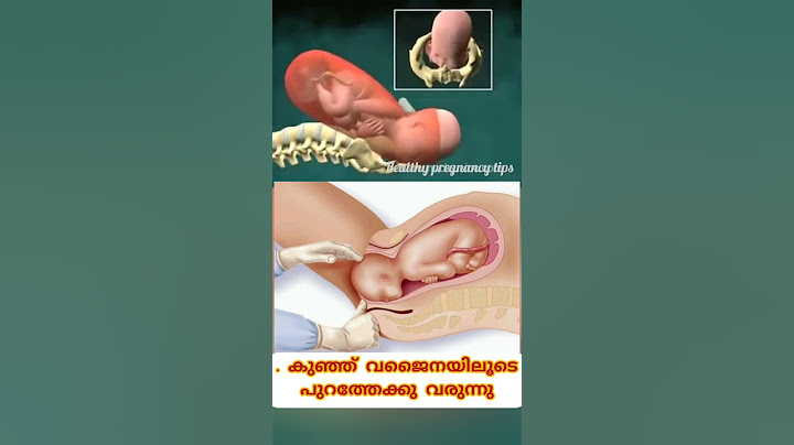 പ്രസവം നടക്കുന്നത് ഈ മൂന്ന് ഘട്ടങ്ങളിലുടെയാണ്.#pregnancy 🤰 #shortsvideo #viralshorts