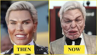 Celebrity 15 Celebrity Plastic Surgery Disasters You’d Never Recognize Today | Then and Now 2026 Net Worth