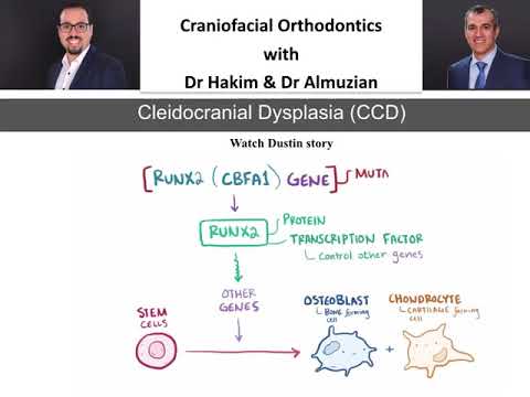 Cleidocranial dysplasia Week 1 overview of the syndrome with Dr Hakim and Dr Almuzian