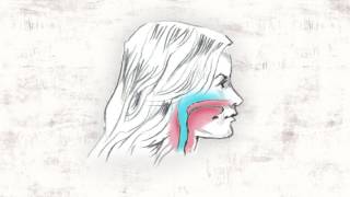 The Story Of Headgear