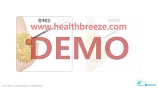 [시연용] b0055aako_유방 조직검사 안내 [축약판]