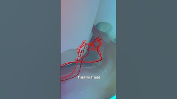 Thumbnail of Why Flossing Causes Bleeding Gums 😬