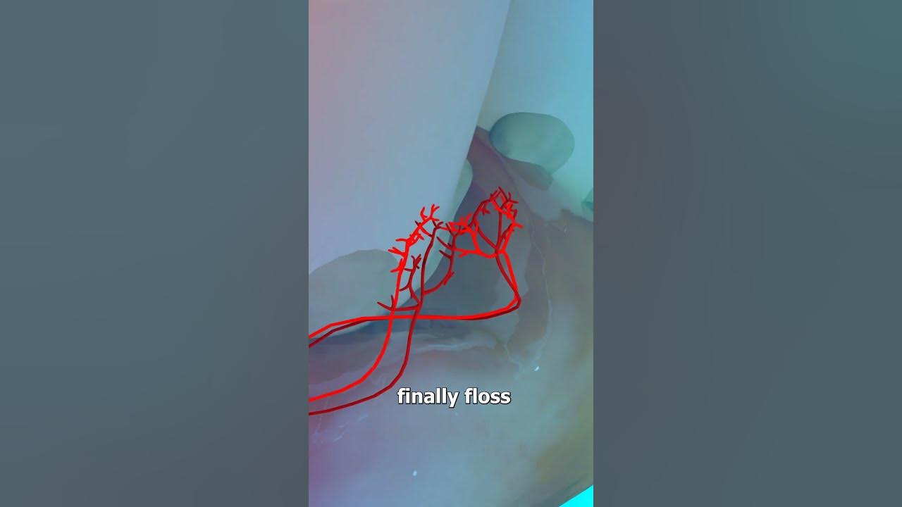 Why Flossing Causes Bleeding Gums 😬