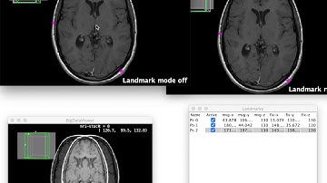 Launching BigWarp from BigDataViewer