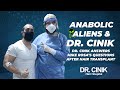 Dr. Cinik Answers Mike Rosa's Questions After Hair Transplant | Hair Transplant | Dr. Emrah Cinik