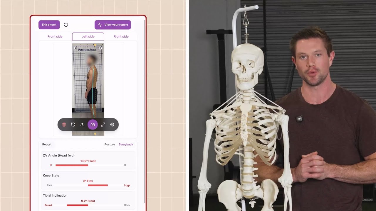 How To Get A Free Posture Assessment
