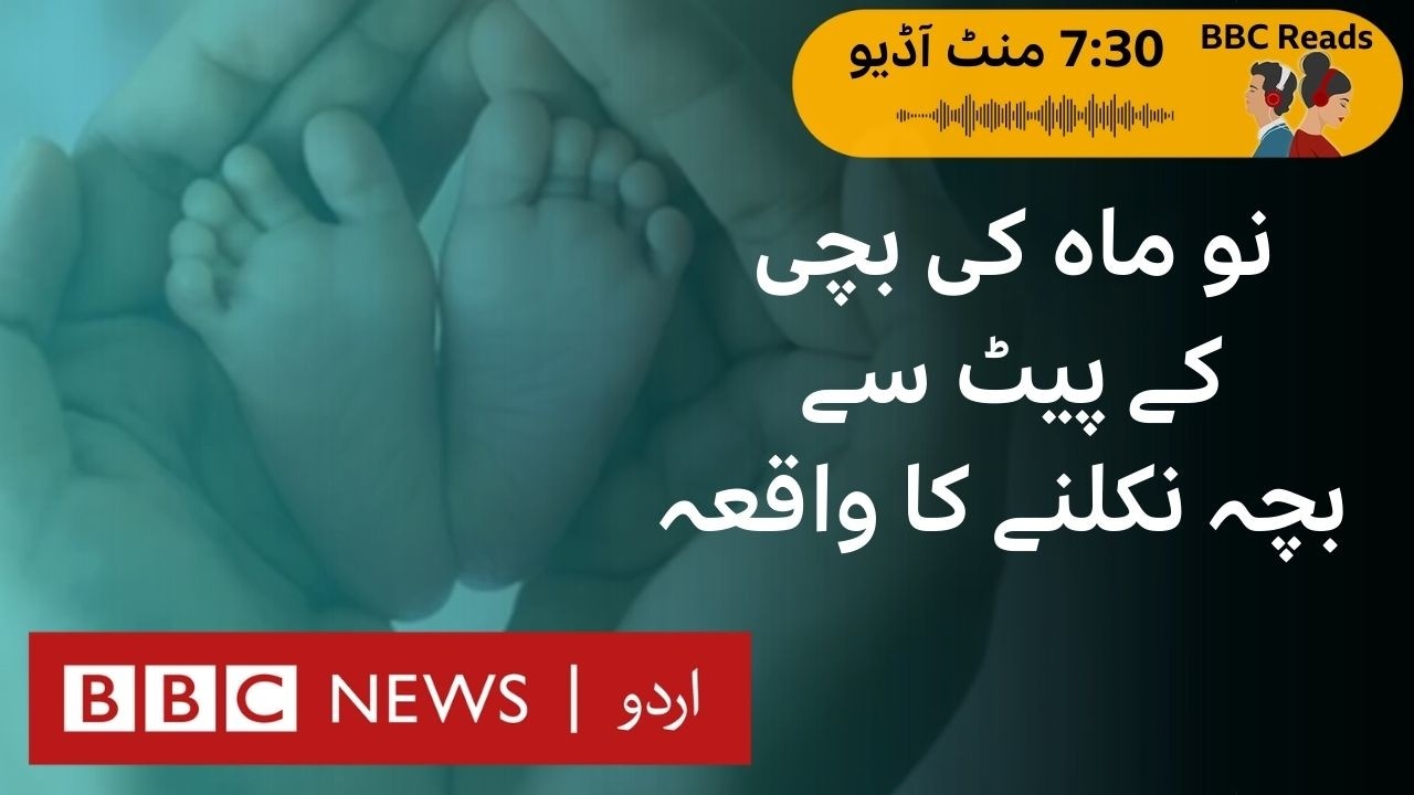 Babies born with another ‘baby’ inside their body  - BBC URDU