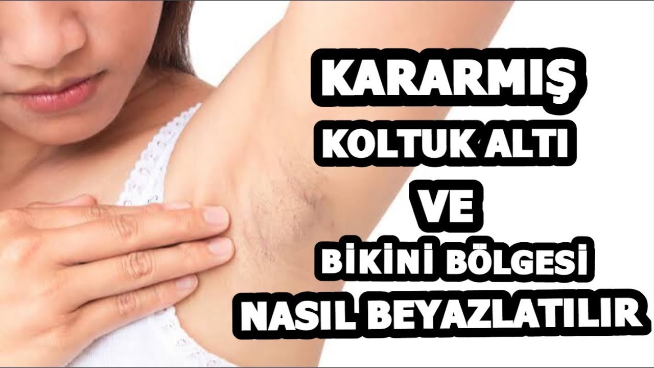 KARARAN KOLTUK ALTI VE DİRSEKLER NASIL BEYAZLAŞTIRILIR? YouTube