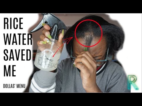 EASY HOW TO: RICE WATER FIXED MY BALD SPOT NO SMELL|DOLLASMENU