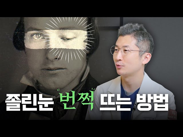 눈 뜰 때 이마 쓴다고 다 안검하수는 아닙니다