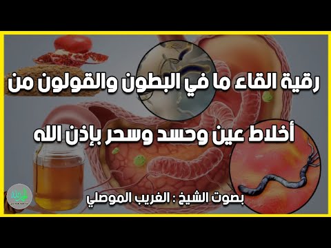 رقية إخراج أخلاط العين والسحر المأكول والمشروب بإذن الله من المعدة الشيخ الغريب الموصلي 