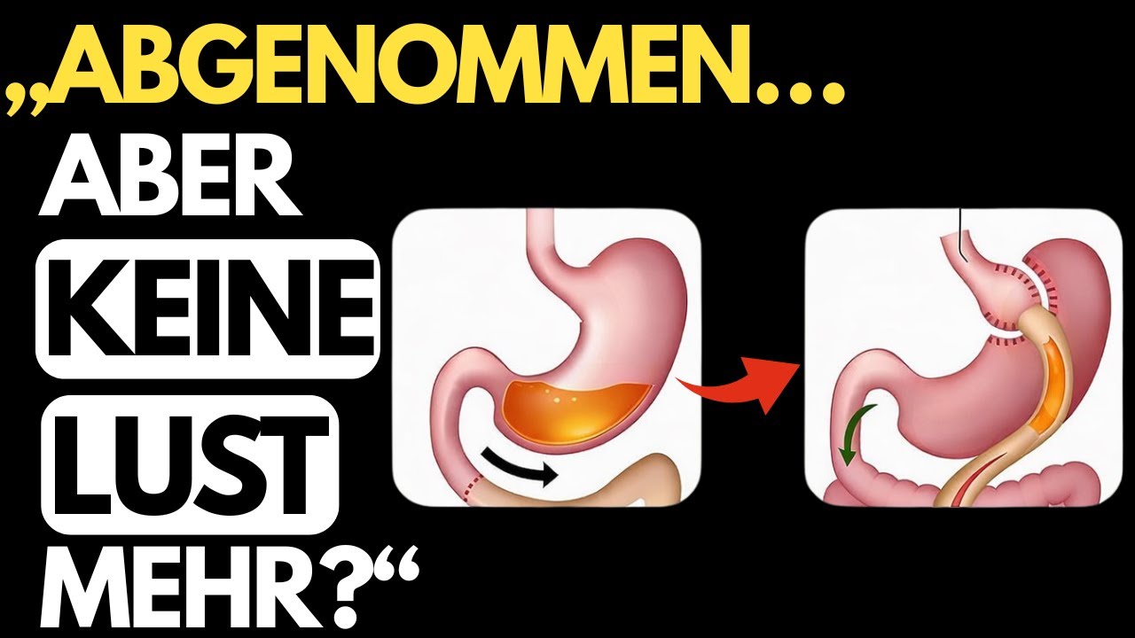 Du hast abgenommen, aber deine Libido ist weg? Die Wahrheit nach der Magen-OP
