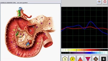 METATRON 4025 HUNTER
