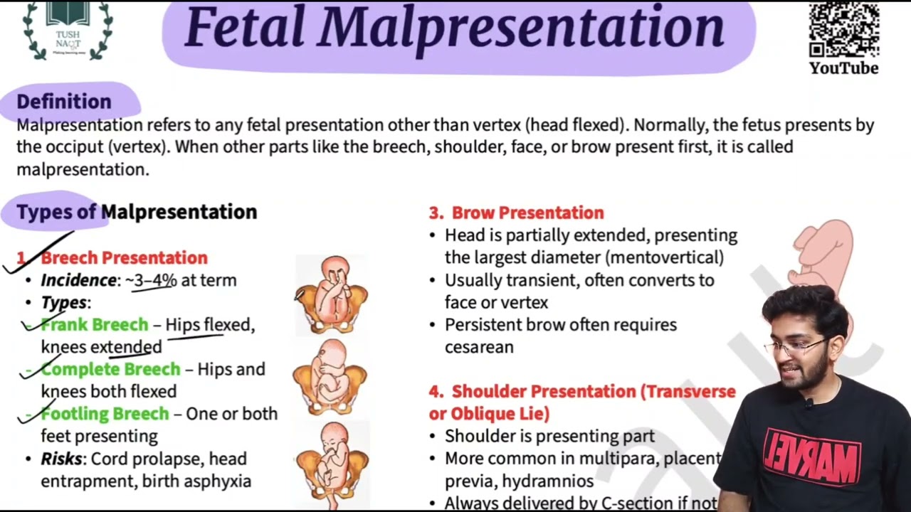 Malpresentation - Easy explanation in Hindi