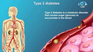 كيف يحدث مرض السكري | أعراضه | طرق الوقاية منه ؟