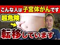 子宮体がんの中高年によくあるパターンの状態を詳しく解説！【不正出血・子宮体がん・女性ホルモン】