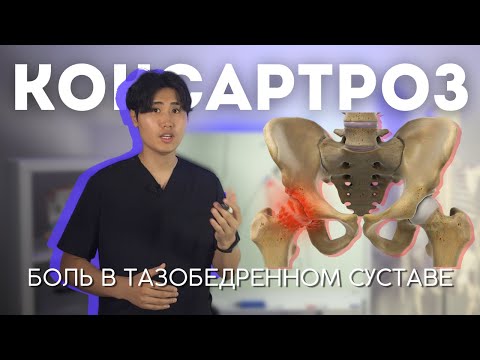 Лучшие упражнения при боли в тазобедренном суставе, коксартрозе