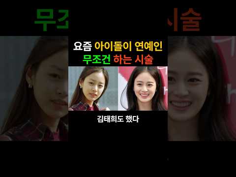 요즘 아이돌 사이에 유행하는 시술