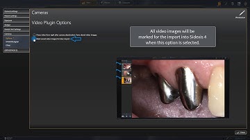 Sidexis 4 and Sirocam - Configuration
