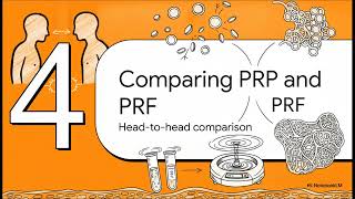 Can autologous platelet-rich fibrin (PRF) matrix be combined with fluid PRP... | WHC Clinical FAQ