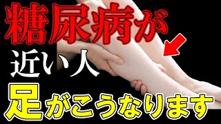糖尿病が近い人だけに起こる「足の異変」症状から予防法まで解説【食事｜血糖値｜ヘモグロビンエーワンシー｜高血糖｜HbA1c】
