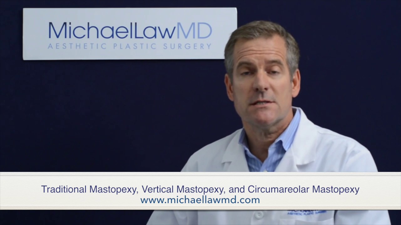 Traditional Mastopexy, Vertical Mastopexy, and Circumareolar Mastopexy YouTube