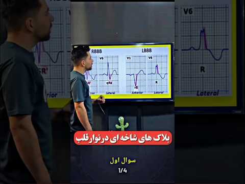 تفسیر نوارقلب بلاک های شاخه ای در نوارقلب