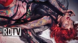 Caitin Stickels, la modelo con síndrome del ojo de gato