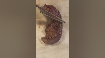 Appendix